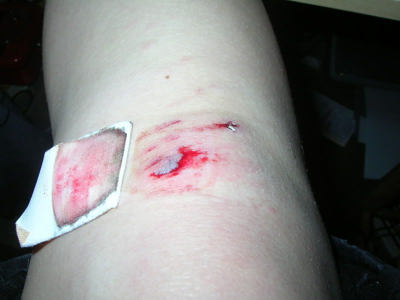Abry - Talking about wounds - RaGEZONE Forums